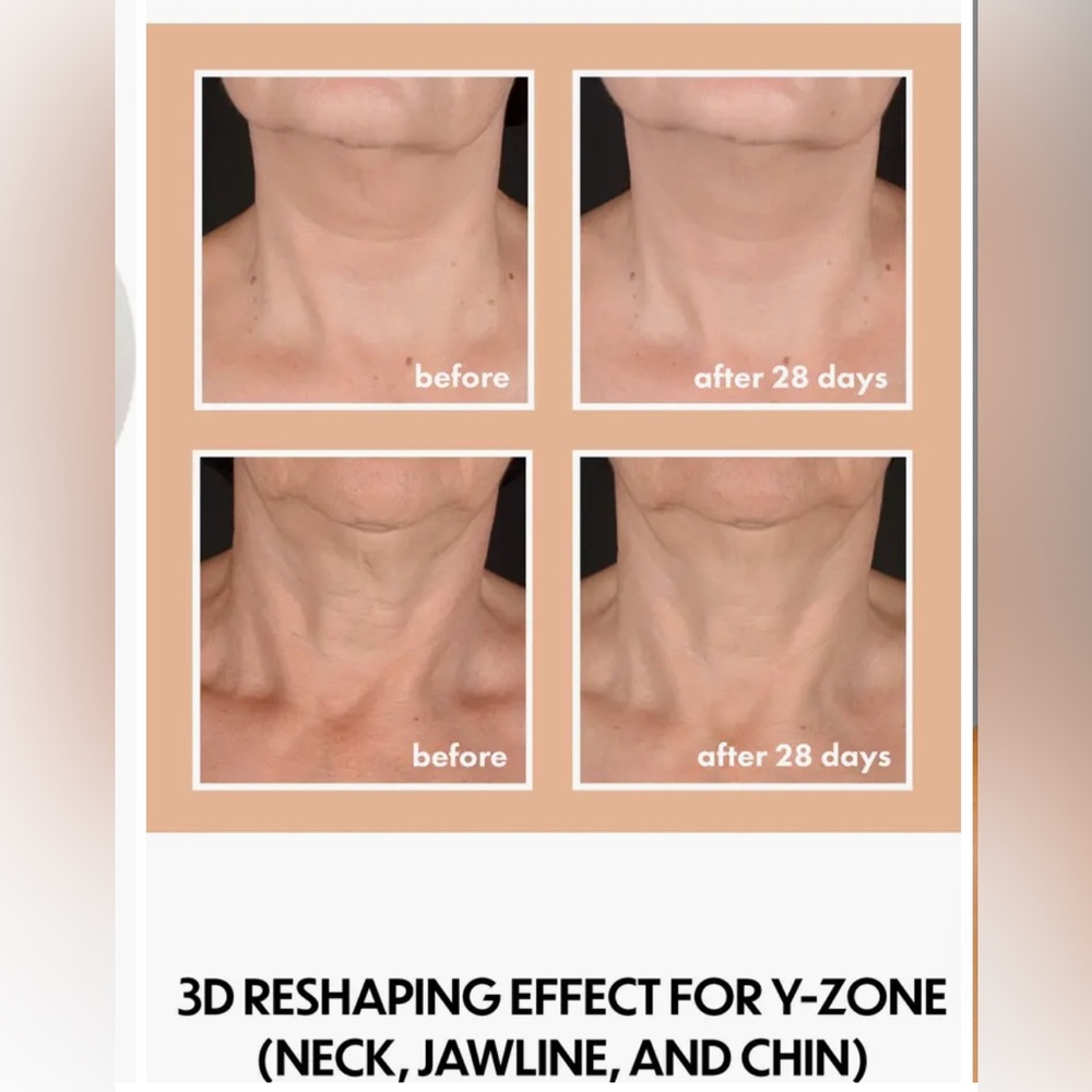 NIB Whish Neck Firming Complex with Bakuchiol